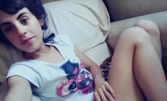 Joven quemada en Del Viso: presenta una leve mejoría pero sigue con pronóstico reservado