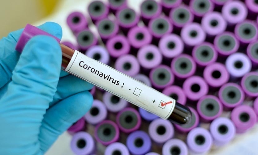 Otras 452 personas murieron y 11.242 fueron reportadas con coronavirus en el país
